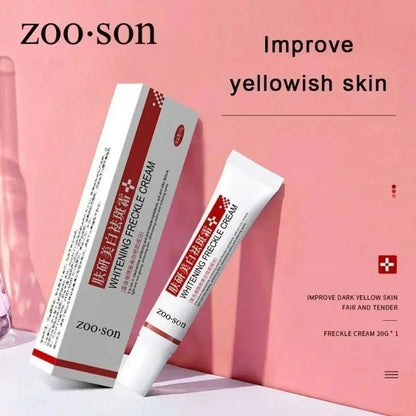 Powerful Spot-removing Whiten Cream Pigmentation Melasma Dark Spot Skin Care 20g